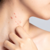 How Dermatologists Diagnose Skin Conditions Effectively