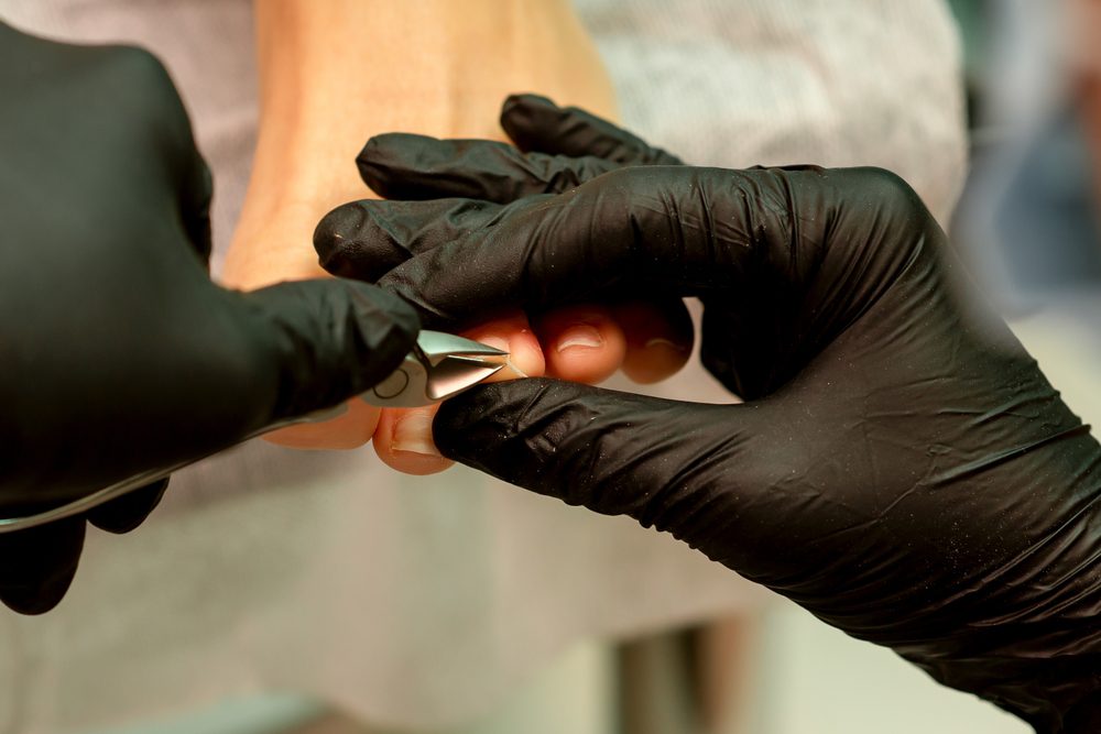 The Benefits of Professional Care for Ingrown Toenails