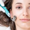 Understanding the Skin Benefits of Microneedling Treatments