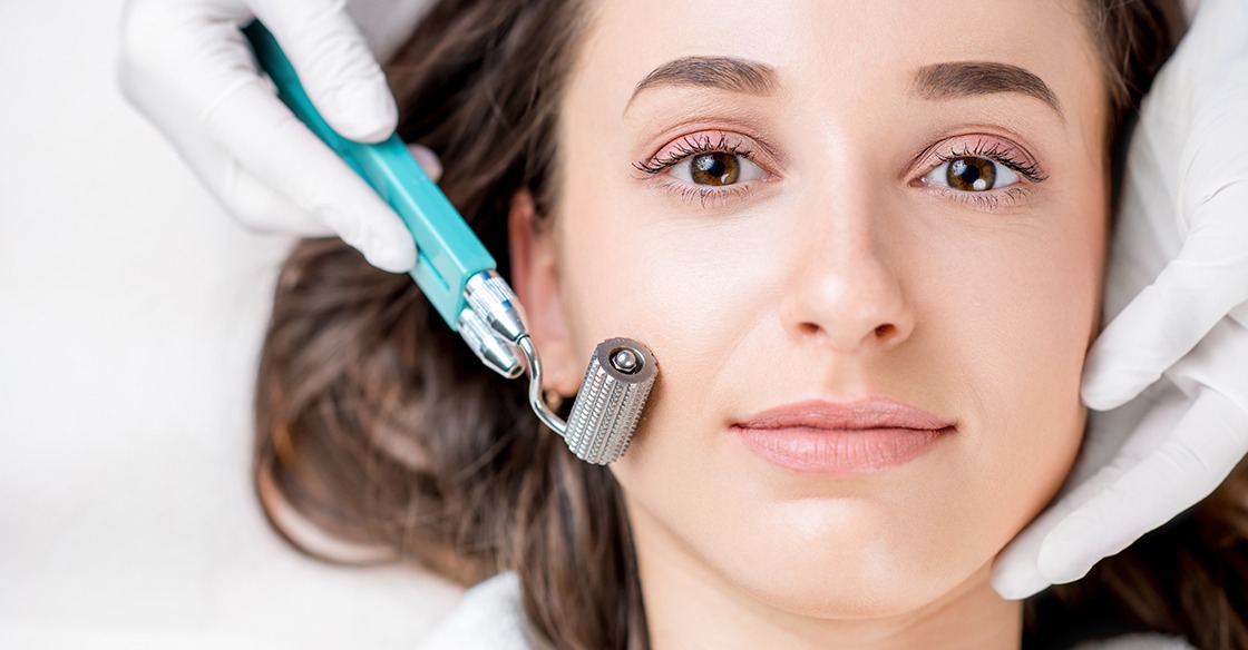 Understanding the Skin Benefits of Microneedling Treatments