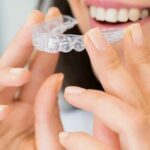 Common Questions and Answers About Invisalign