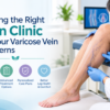 Finding the Right Vein Clinic for Your Varicose Vein Concerns