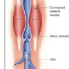How Minimally Invasive Treatments Address Spider Veins