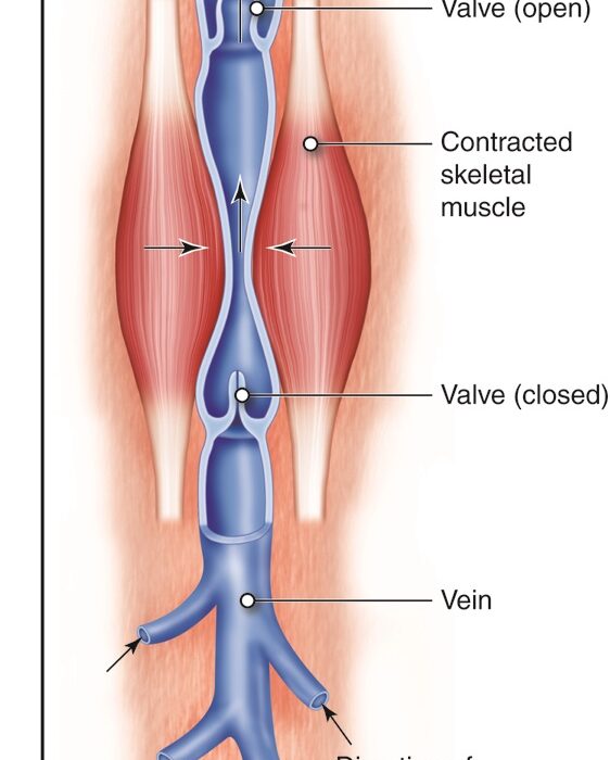 How Minimally Invasive Treatments Address Spider Veins