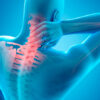 Steps to Take Following a Neck Injury to Support Proper Healing