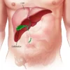 Tips for a Smooth Recovery After Gallbladder Removal