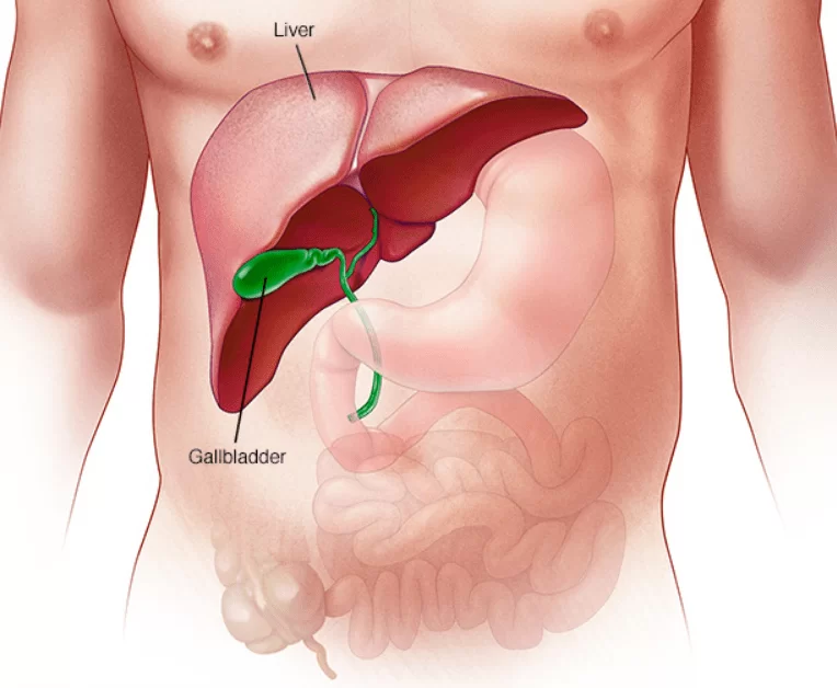 Tips for a Smooth Recovery After Gallbladder Removal